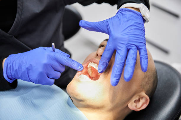 Best Emergency Dental Care for Sports Injuries in Hampstead, MD