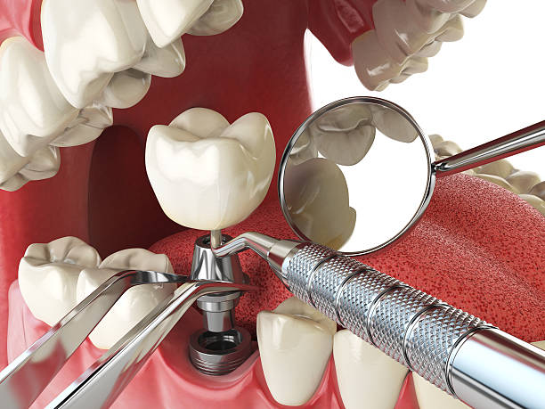 Reliable MD Emergency Dental Service Solutions